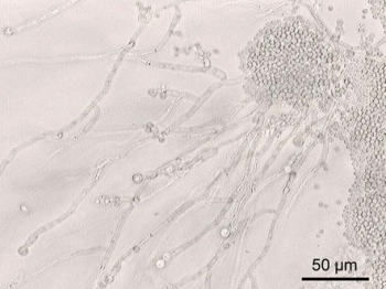 カンジダ菌の顕微鏡写真