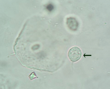 トリコモナス原虫の顕微鏡画像