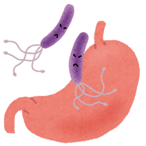 ピロリ菌の検査をする時は胃の粘膜から胃の組織(細胞)を取って検査