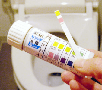 尿検査の項目と数値の見方
