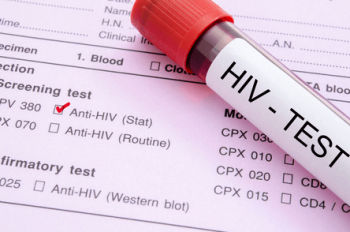 HIV感染症の初期症状はいつからどれくらい続く？