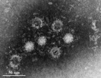 E型肝炎ウイルスの電子顕微鏡画像